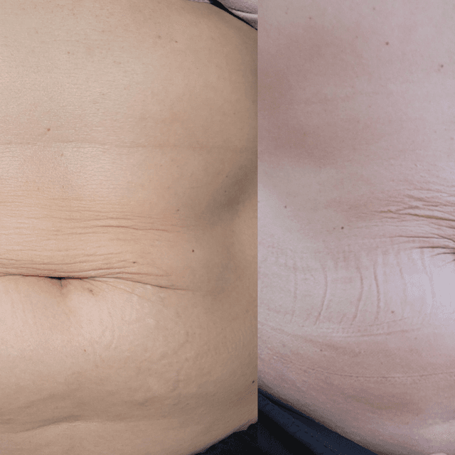 ULTIMATE SCULPT TRANSFORMATION PKG at GloVolution LLC in Homosassa, FL