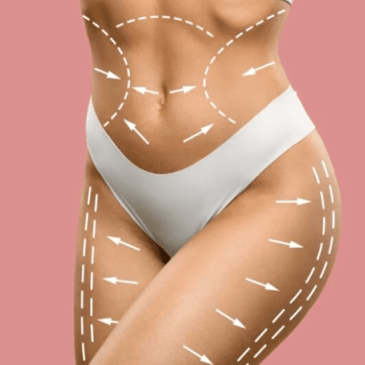 CryoContouring & Sculpting Package at GloVolution LLC in Homosassa, FL