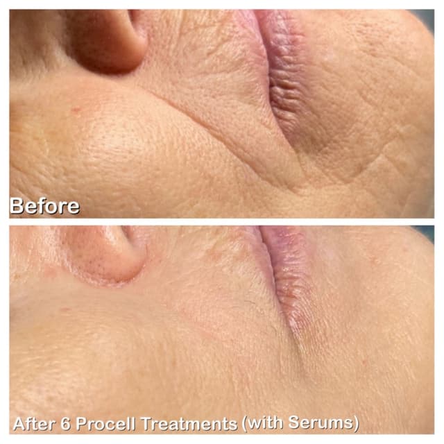 Rapid Weight Loss Face Series at GloVolution LLC in Homosassa, FL